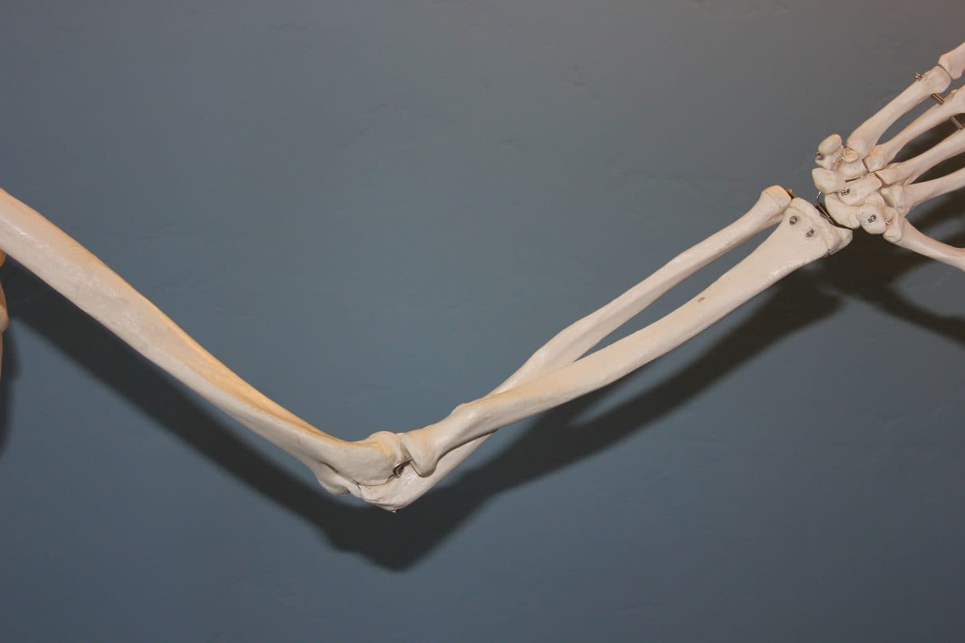 A skeletal model of the arm and elbow